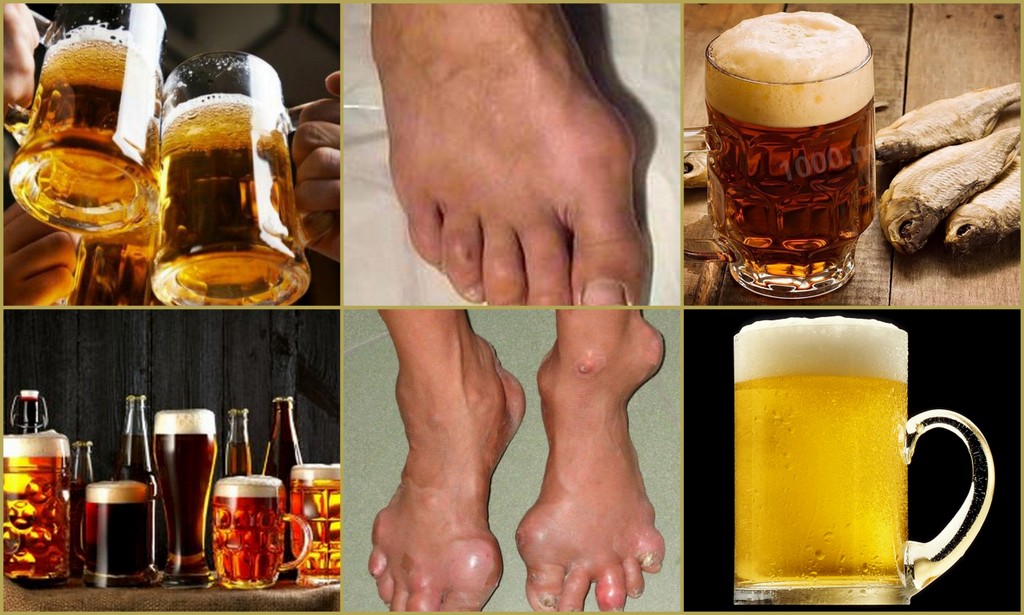 Пиво: польза и вред. мифы о вреде и пользе пива