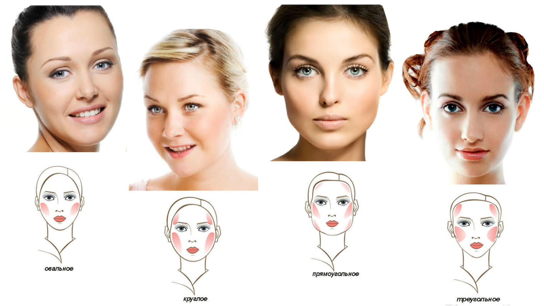 Влияние неправильного прикуса на внешность: опущенные уголки губ, уменьшение лица, асимметрия лица и прочее