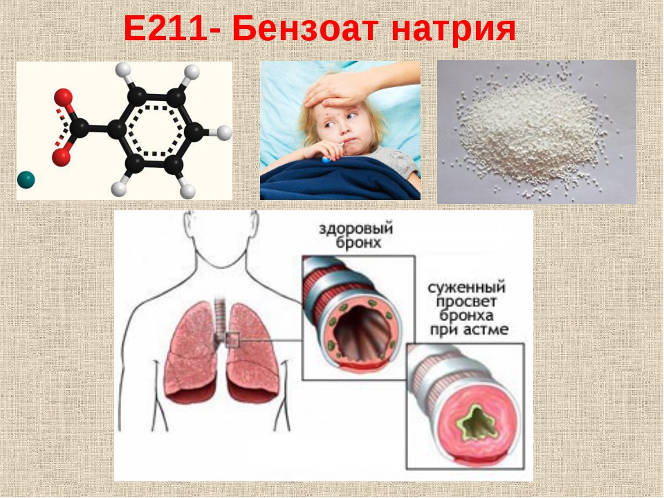 Е211 – бензоат натрия: полезные и вредные свойства консерванта. чем так опасен для организма бензоат натрия?